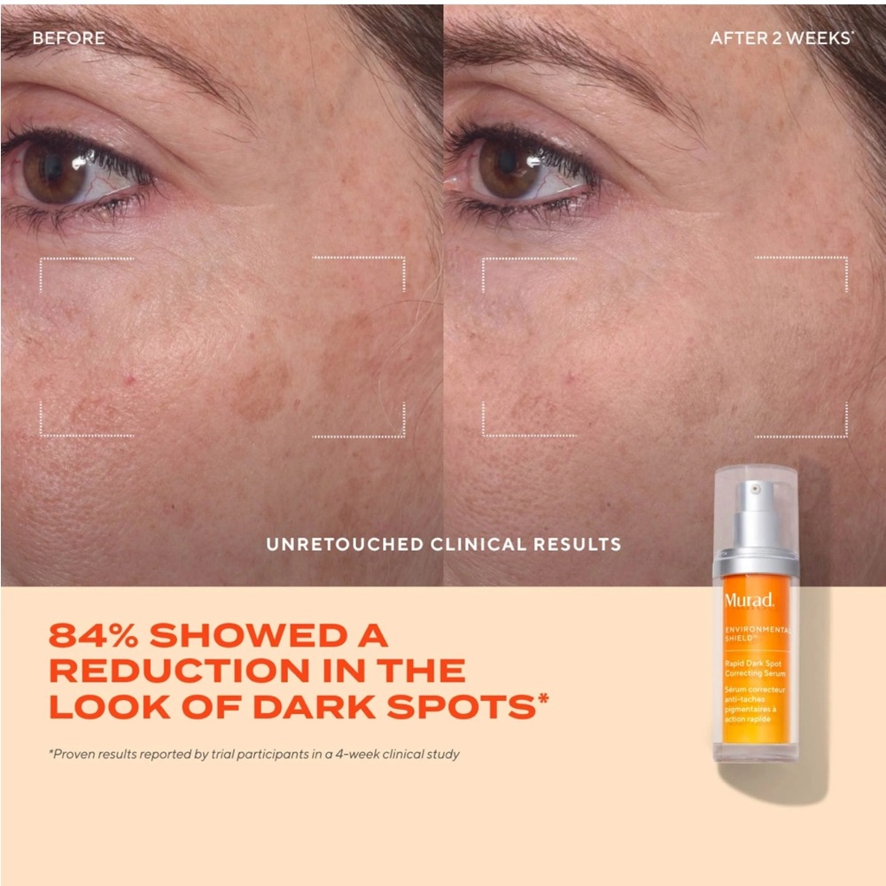 Murad Rapid Dark Spot Correcting Serum - Picture 2 of 8